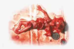 However You Do Have A Right To Stop Having Unproctected - Not Your Body Abortion Meme #7947