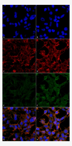 Smc 511 4 Hydroxynonenal Antibody 12f7 Icc If Human - 4 Hne Immunohistochemistry #1005593