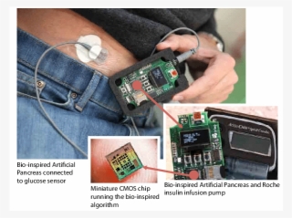 The Bio-inspired Artificial Pancreas - Electronic Component #10061438