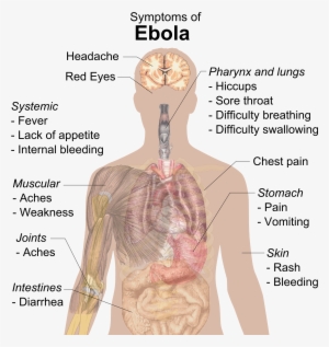 Symptoms Of Ebola - Ebola Symptoms In Spanish #1017542