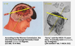 John F Kennedy Autopsy #1019917