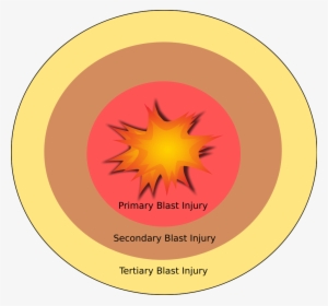 Open - Explosion Anatomy #1030634