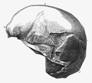 Side View Of The Cast Of Part Of A Human Skull Found - Clip Art #1123808