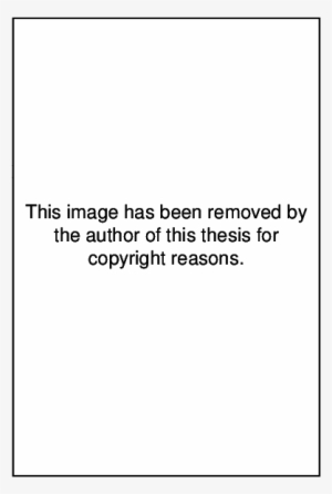 Metal Frame And Pelvic Restraint Device - Bitung #1125749 Metal Frame And Pelvic Restraint Device - Bitung #1125749