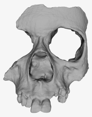 Source - - Bone #1146203