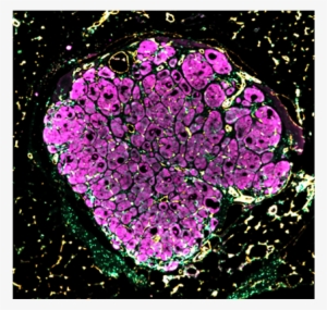 Engineered Human Liver Tissue “seeds” Blossom After - Liver #1153638