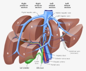 Pld Liver Resection Polycystic Liver Disease Adpld - Liver Lobes Anatomy #1153657