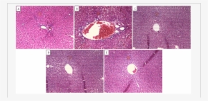 Effect Of Drug Treatment On Liver Histopathology Of - Liver #1153758