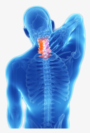 Treatment Neck Pain - Cure For Neck Pain #1252882