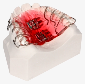 Upper Spit Plate - Ring #1271776 Upper Spit Plate - Ring #1271776