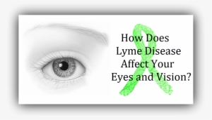 How Has Lyme Disease Affected Your Vision - Lyme Disease Eyes #1282936