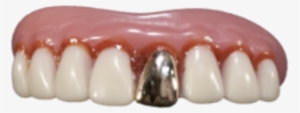 The Original Billy-bob Full Grill Gold Tooth - False Gold Teeth #1309064