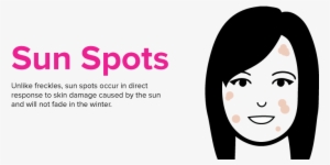 Because Of This, One Of The Best Ways To Reduce The - Freckles Caused By Sun #140161 Because Of This, One Of The Best Ways To Reduce The - Freckles Caused By Sun #140161