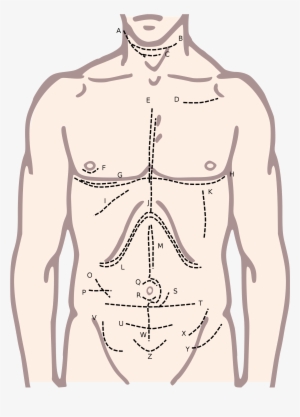 Anatomy[edit] - Mcevedy Incision #1455666
