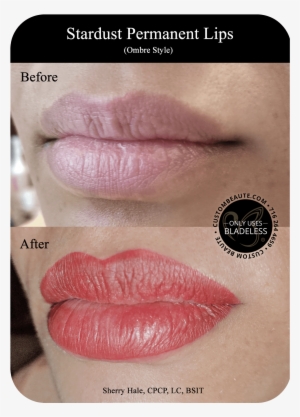 Before And After Permanent Eyeliner - Permanent Lip Tattoo Before And After #1477575