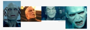 Voldemort Is A Scare Face And Two Slits For His Nose - Lord Voldemort #1649297