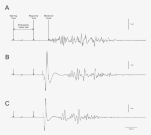 Electromyography Sample Record From The Biceps Brachii - Electromyography #1662503