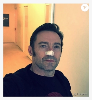 Hugh Jackman Après Une Nouvelle Opération Visant À - Michael Gracey Without Hat #1708478