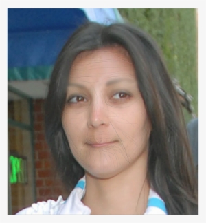 Kim's Lips Before And After #1723680