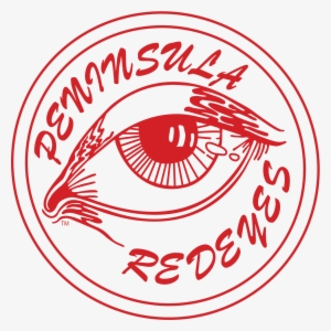 Peninsula Redeyes Round Vinyl Sticker - Posting #182261