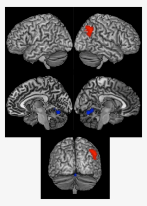 Results Of The Whole Brain Searchlight Analysis Showing - Perception Of Speech: From Sound To Meaning #1837563