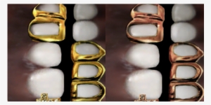 Grillz Info 💀 - Pill #1852643