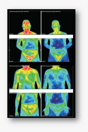 Before And After Taking Double Helix Water - Human Body Temperature #1882516