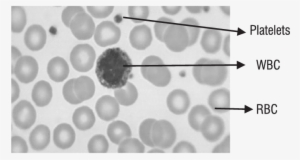 A Sample Blood Smear Showing Rbc, Wbc, Platelets Table - Pernicious Anemia Vs Normal #1927821