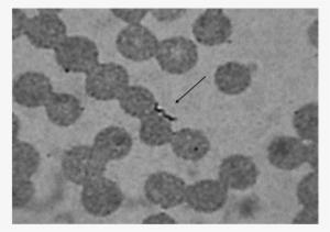 Leptospira In Blood - Leptospira Blood #1928153