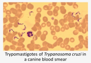 Trypanosoma Cruzi Method Of Diagnosis Find Amastigotes - Trypanosoma Cruzi #1928249