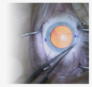 Visioncare Sumit Garg, Md - Painting #1939936