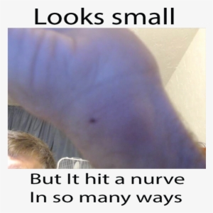 Ouch - Netgear Router Reset Button #1969696