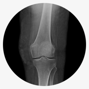 Medical Imaging #1993077