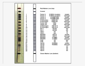 Design Of Cvd Strip Assay Test Used In The Current - Cvd Strip Assay #2024435