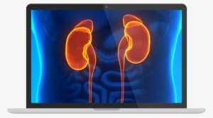 Macbook - Kidney #2028400