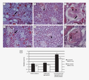 Kidney Pathology In No-treated Shrsp And In Shrsp Under - Secretion #2028466