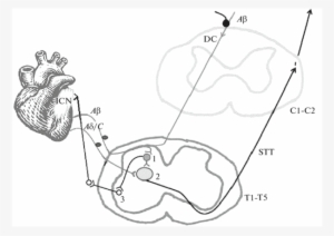 The Scheme Of Effects Of The Spinal Cord Electrical - Spinal Cord #2050425