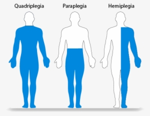 Conventional Method To Treat A Spinal Cord Injury - Paraplegia Quadriplegia And Hemiplegia #2050542