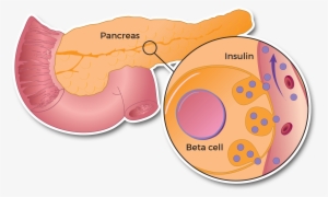 About Diabetes - Diabetes Mellitus #2052102