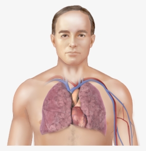What Is Pulmonary Fibrosis - Meat #2085224