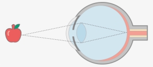 Fig1 In Focus Final - Portable Network Graphics #2141783