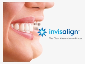 //cdn2 - Hubspot - - Clear Aligners #2148250