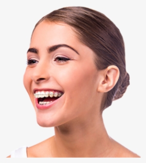 Treating Faces, Designing Smiles - Special Offer For Braces #2148287