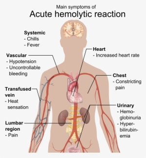 Main Symptoms Of Acute Hemolytic Reaction - Acute Hemolytic Reaction #2161052