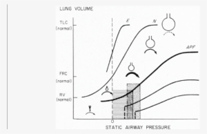 Use Of The Pressure/volume Curve To Personalize Peep - Cartoon #2252000