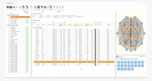 In-home Video Eeg And Ltm Monitoring #2257877