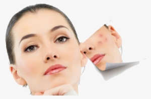 How To Get Rid Of Sunspots - Veluxio Naturals Best Blackhead Remover And Comedone #2283865