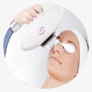 How Does Ipl Treatment Reduce Ance - Circle #2284915