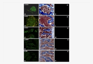 At 14 Days Cells Located In The Vicinity Of Bone And - Tissue #234139