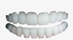 Human Teeth Png Svg Library Download - Human Tooth #238403